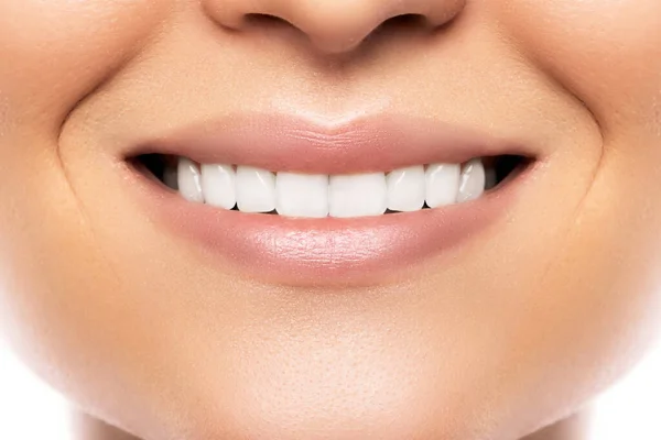 Fechar Belo Sorriso Feminino Com Dentes Brancos — Fotografia de Stock