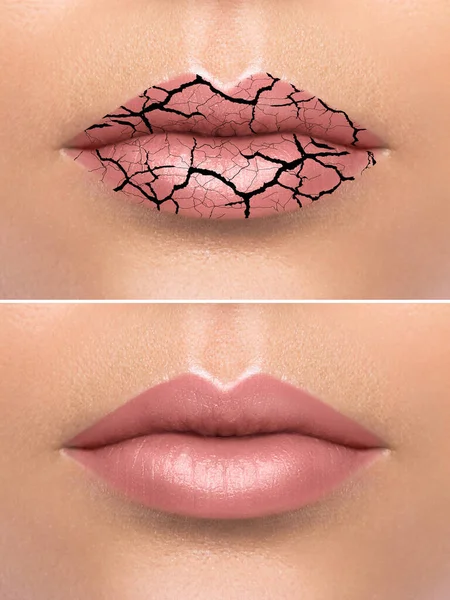 Huid Gezondheid Gebroken Vrouwelijke Lippen Behandeling — Stockfoto