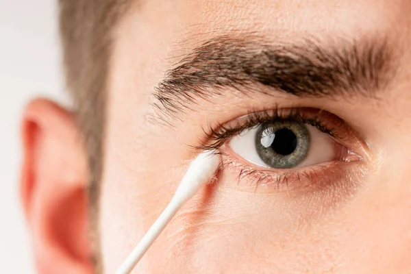 Young Man Cleaning His Eye Cotton Swab — Stock Photo, Image