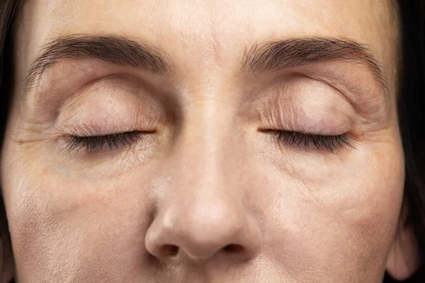 Ojos Cansados Mujer Mediana Edad Conceptos Envejecimiento Cosmetología Salud — Foto de Stock