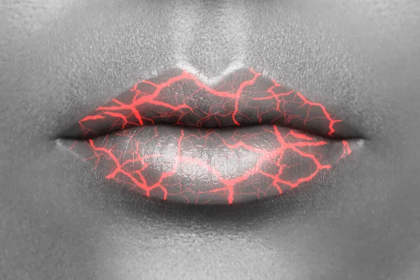 Cracks Female Mouth Concept Chapped Lips — Stock Photo, Image