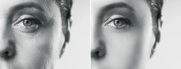 여성의 얼굴을 비교해 놀라울 정도의 과정이나 과정을 여성의 비교해 — 스톡 사진