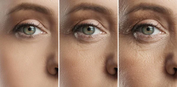 Kvinnliga Ögon Representerar Åldrande Koncept Jämförelse Mellan Unga Medelålders Och — Stockfoto
