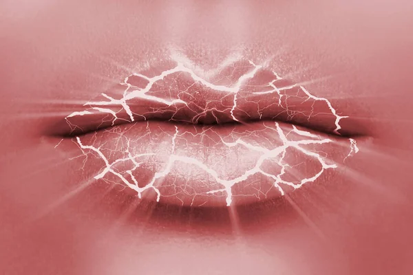 Cracks Female Mouth Concept Chapped Lips — Stock Photo, Image