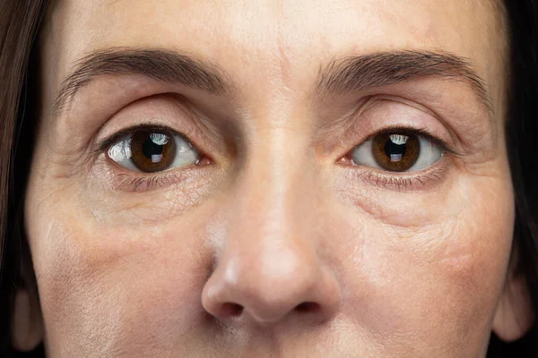 Ojos Cansados Mujer Mediana Edad Conceptos Envejecimiento Cosmetología Salud —  Fotos de Stock