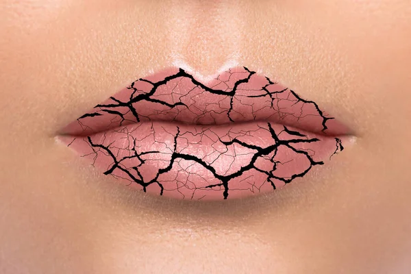 Pęknięcia Kobiecych Ustach Pojęcie Warg Spierzchniętych — Zdjęcie stockowe