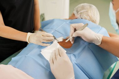 Doktor ve hemşire estetik tıp kliniğinde dermatolojik ameliyatın kaldırılması sırasında...