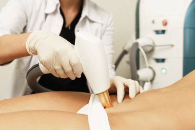 Tıbbi estetik kliniğinde sezaryen ameliyatından sonra IPL tedavisi ve yara aldırma