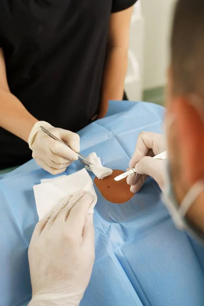 Médico Enfermera Durante Extirpación Marcas Nacimiento Cirugía Dermatológica Clínica Médica — Foto de Stock