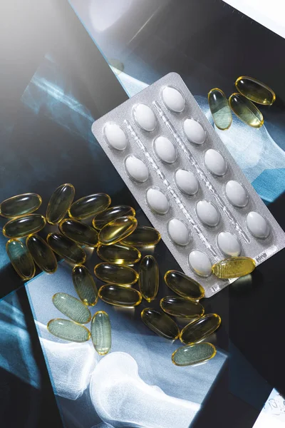 Close Van Röntgenfoto Visolie Capsules Witte Pillen Voedingssupplementen Geneesmiddelen — Stockfoto