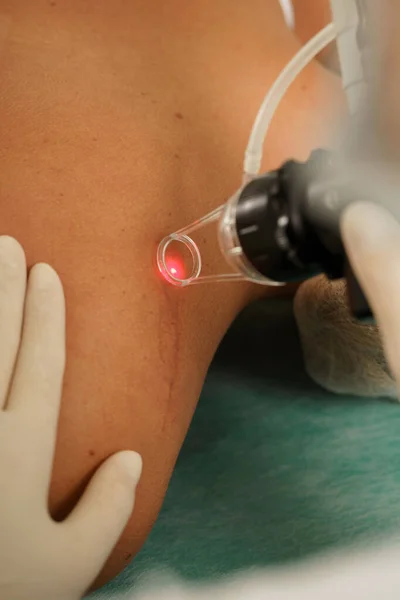 Dermatologe Und Kundin Während Der Laser Hauterneuerungsbehandlung Einer Medizinisch Ästhetischen — Stockfoto