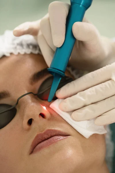 Cliente Mujer Durante Extracción Del Lunar Láser Una Clínica Médica — Foto de Stock