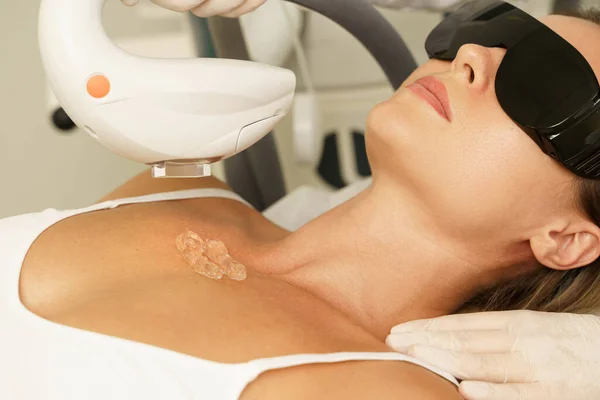 Vrouwelijke Cliënt Tijdens Ipl Behandeling Een Kosmetologische Kliniek — Stockfoto