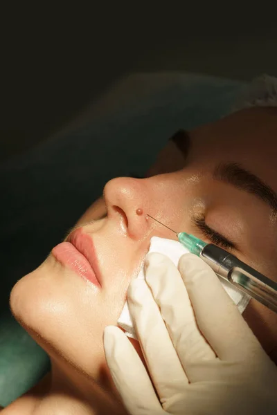 Woman Client Getting Injection Local Anesthetic Mole Removal Treatment Medical — Stock Photo, Image