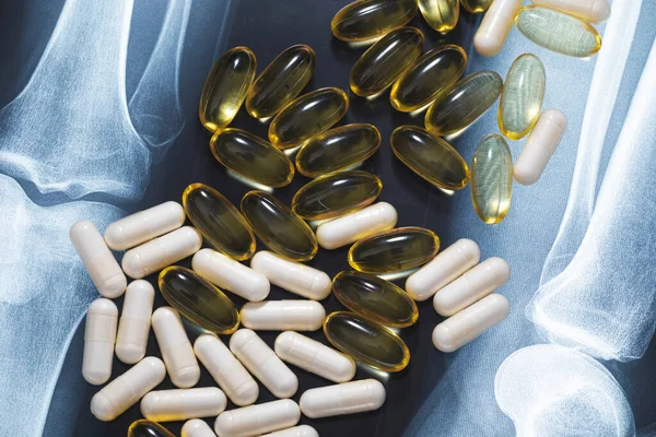 Close Van Röntgenfoto Visolie Capsules Witte Pillen Voedingssupplementen Geneesmiddelen — Stockfoto