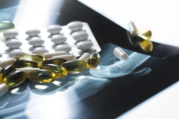 Detailní Záběr Rentgenového Snímku Tobolek Rybího Oleje Bílých Pilulek Doplňky — Stock fotografie