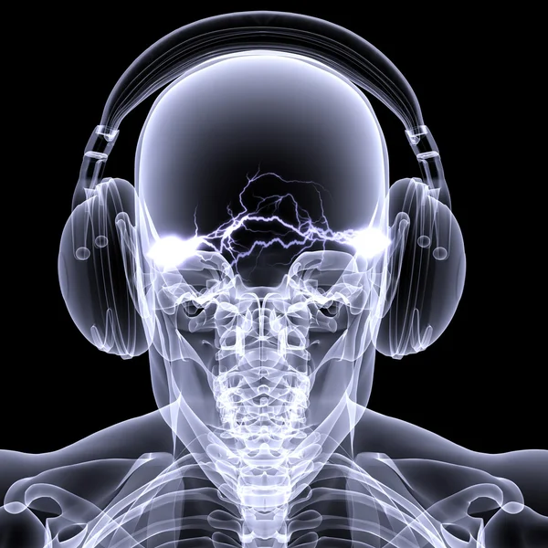 Skeleton X-Ray - DJ 3 — Stock Photo, Image