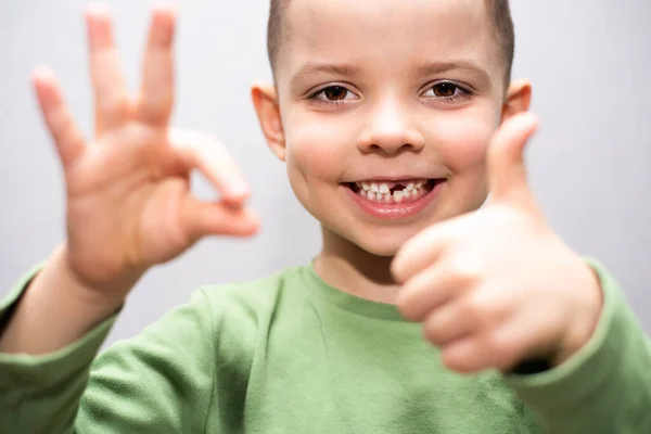 Bonito Emocional Criança Menino Sem Frente Leite Dente Sorrindo — Fotografia de Stock