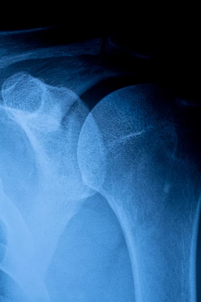 Рентгеновское изображение человеческих костей — стоковое фото