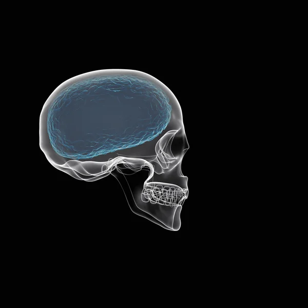 Human brain with skull x-ray view — Stock Photo, Image