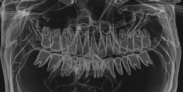 Dientes humanos. Efecto de rayos X —  Fotos de Stock