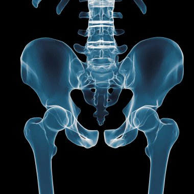 pelvis röntgenleri altında