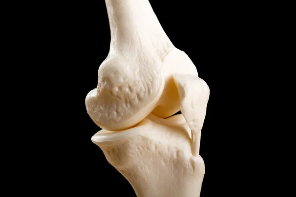 人体膝关节的解剖 — 图库照片