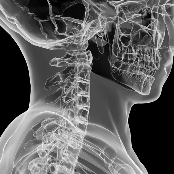 X-ray προβολή ανθρώπινη αυχενικής μοίρας — Φωτογραφία Αρχείου