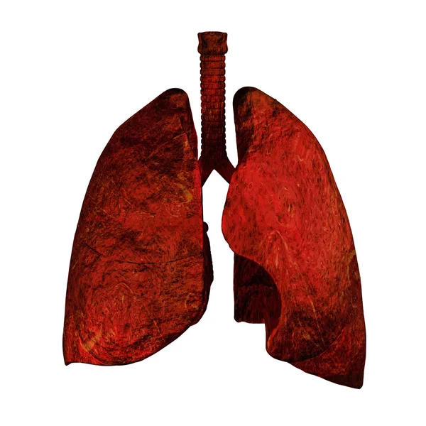 Lungs od Smokers — Stock Photo, Image