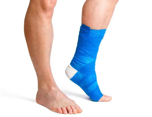 Homem com perna quebrada — Fotografia de Stock