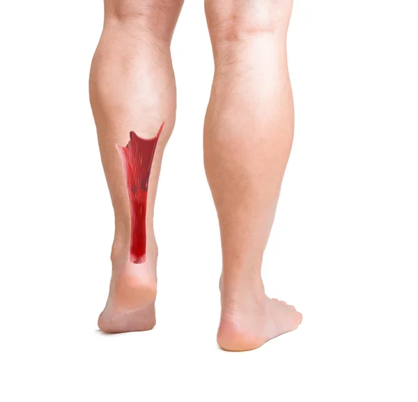 Tendão de aquiles com músculos da perna inferior — Fotografia de Stock