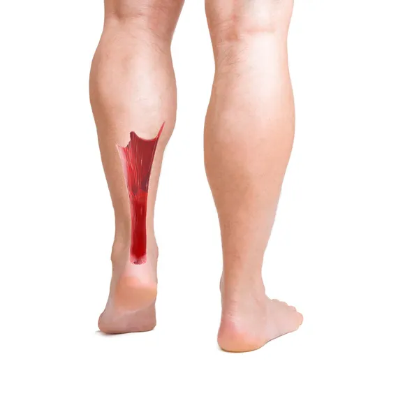 Achilles pees met lagere beenspieren — Stockfoto