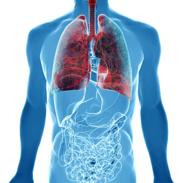 X 線ビューの肺癌 — ストック写真