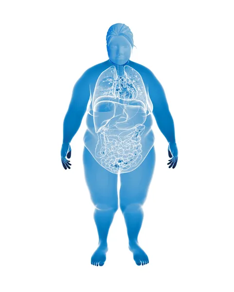 Overweight Female with interior organs — Stock Photo, Image