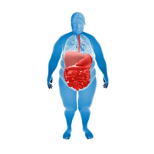 Overweight Female with hihglighted digestive system — Stock Photo, Image