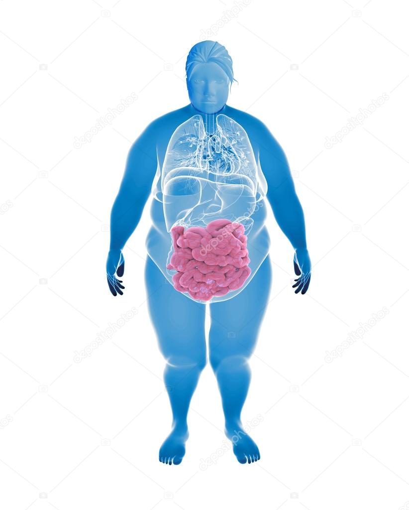 Overweight Female with hihglighted Small intestine