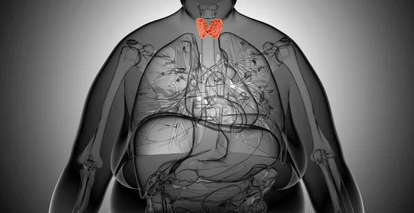 X-ray  illustration of the Overweight woman with  thyroid gland — Stock Photo, Image