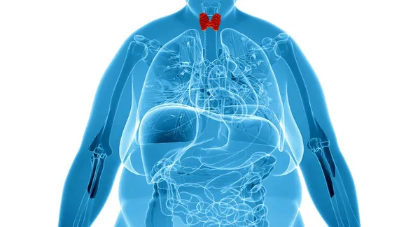 Röntgen illustration av överviktiga kvinnan med sköldkörteln — Stockfoto