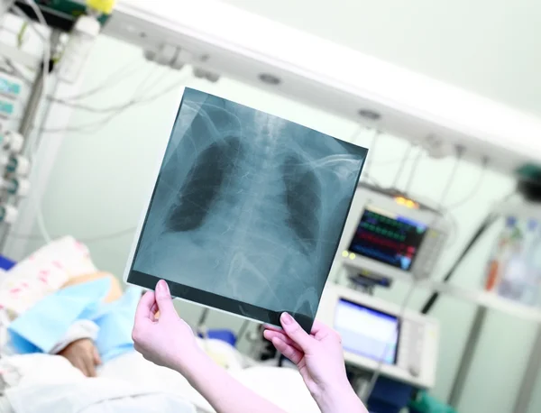 Frau mit Röntgenbild in modernem Krankenhaus — Stockfoto