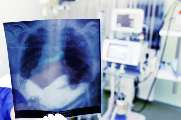 Demonstration of an x-ray in clinic — Stock Photo, Image