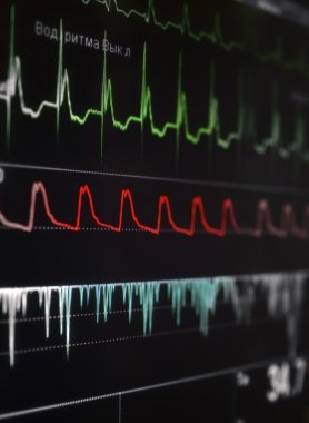 Dalgalar parlak parçası ile cardiomonitor.