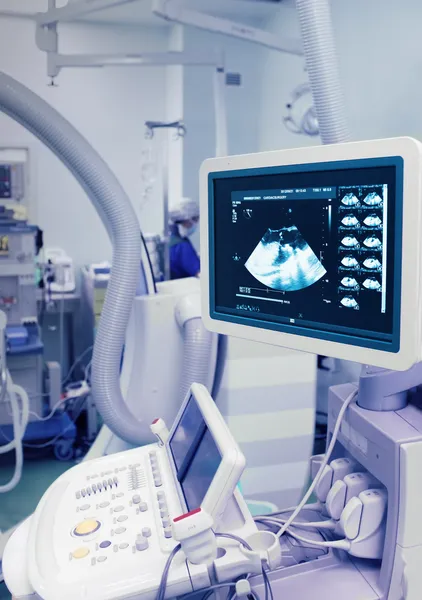 Dispositivo de ultrasonido en un laboratorio de rayos X. Diagnóstico durante la sobretensión — Foto de Stock