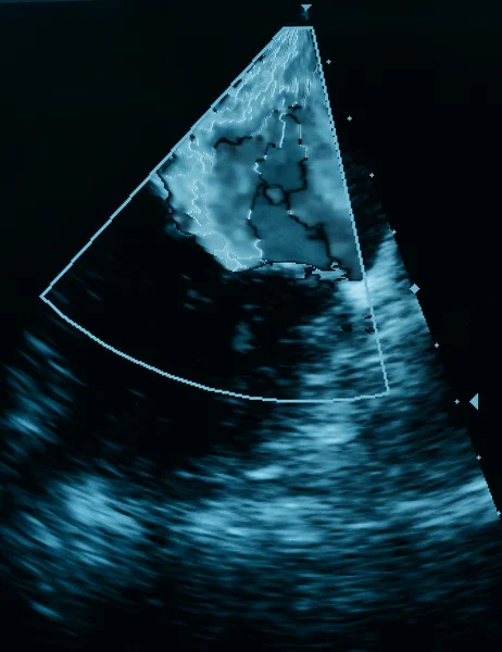 Máquina de ultrasonido de pantalla. diagnósticos de símbolo en la atención sanitaria — Foto de Stock