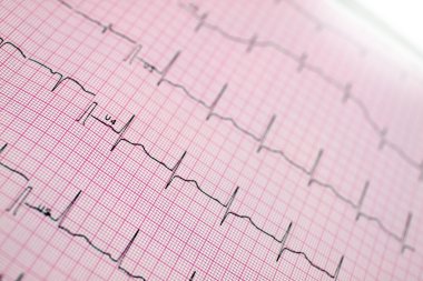 EKG. stilize fotoğraf