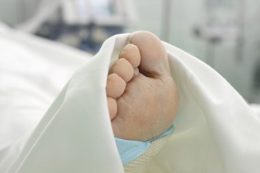 mantar enfeksiyonu belirtileri.