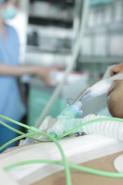 hasta yoğun bakımda. Vantilatör görünür endotrakeal tüp. pH