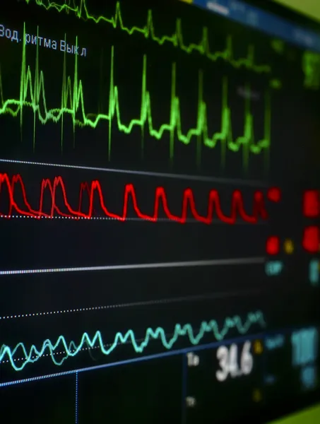 Монітор в у відділенні інтенсивної терапії. — стокове фото