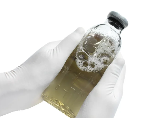 Botella con líquido amarillo en la mano de un médico, fot aislado — Foto de Stock