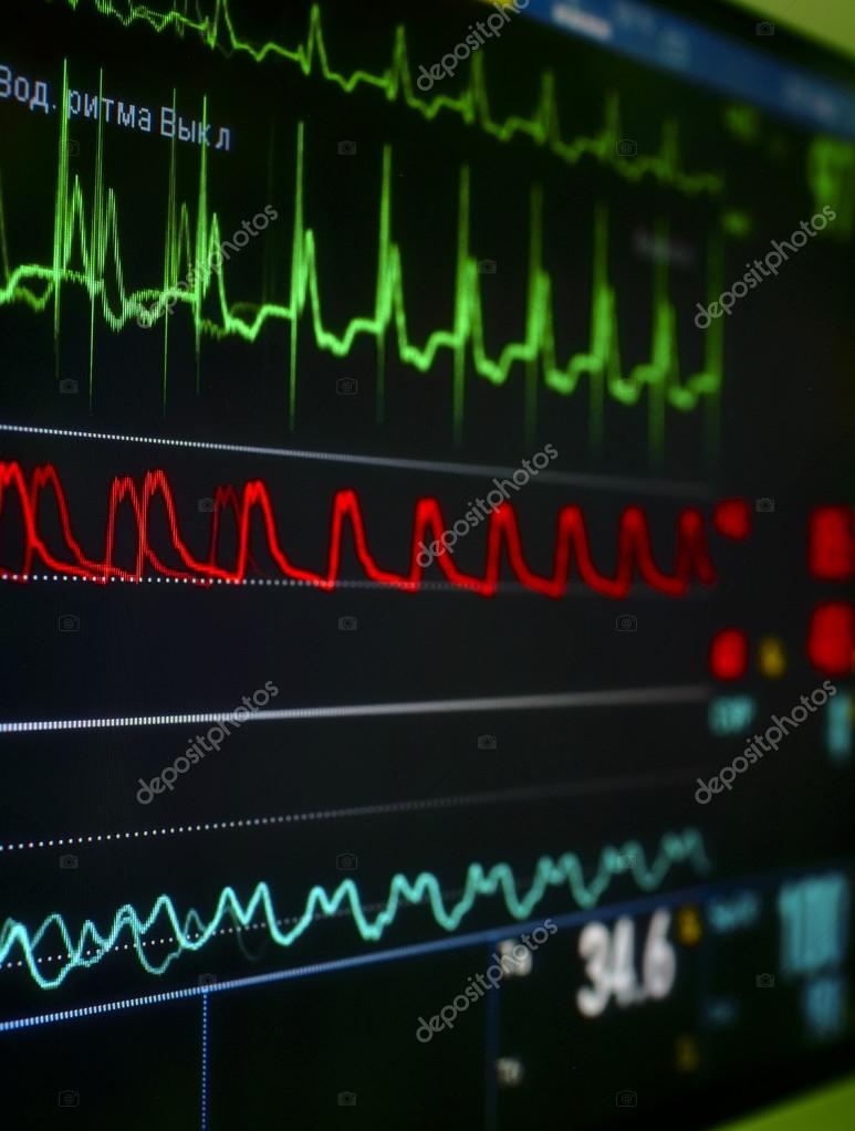 Monitor in the ICU. — Stock Photo © sudok1 22888868