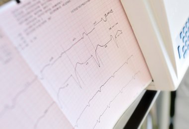 Elektrokardiyogram yazdırma.